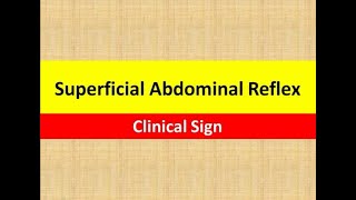 Superficial Abdominal Reflex  Clinical Sign  Neurology [upl. by Eicnahc791]