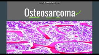 Rheumatoid Arthritis Pathophysiology  Rheumatoid Arthritis Pathogenesis  Arthritis pathophysiology [upl. by Arec]