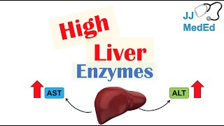 High Liver Enzymes  Aspartate vs Alanine Aminotransferase AST vs ALT  Causes [upl. by Pisarik]