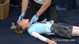 Unconscious Child Choking [upl. by Pepper]