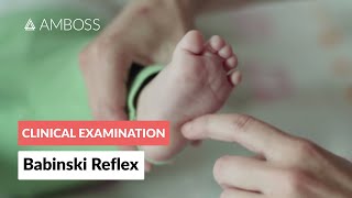 Babinski Reflex in Infants  Clinical Examination [upl. by Nehte]