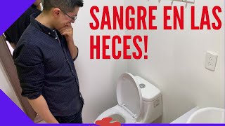 Sangre en las heces  causas de evacuar sangre [upl. by Atat476]