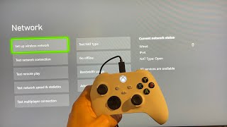 Xbox Series XS How to Fix Cannot Obtain IP Address Tutorial Network Settings 2025 [upl. by Fondea]