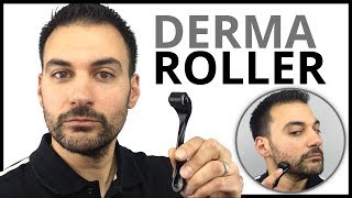 Derma Roller  Patchy Beard Growth Solution [upl. by Oilisab453]