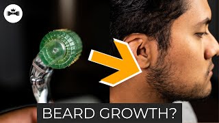 Derma Roller for Beard  What You Need to Know  Microneedling [upl. by Ushijima]