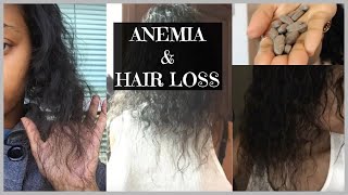 Anemia amp Hair Loss My Story and Recovery [upl. by Enitnelav]