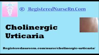 Cholinergic Urticaria [upl. by Niotna]