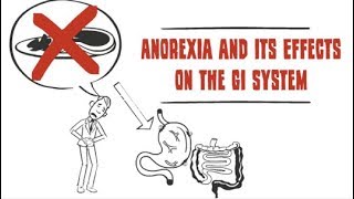 How anorexia affects the digestive system [upl. by Oiliruam]