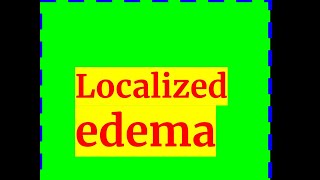 LOCALIZED EDEMA [upl. by Rigby]