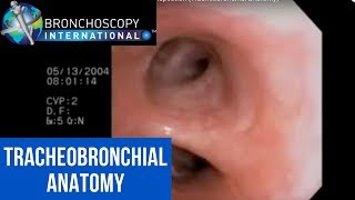 Flexible Bronchoscopy Introduction 7  Airway Inspection Tracheobronchial Anatomy [upl. by Marabelle]