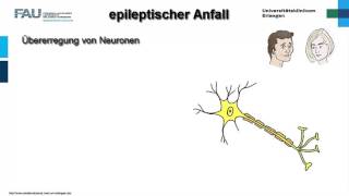 Neuropathologie ─ Epilepsie [upl. by Laurentium]