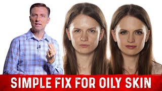 How To Fix Oily Skin With Simple Hack – Dr Berg [upl. by Bore679]