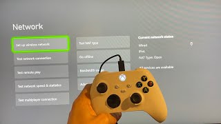 Xbox Series XS How to Fix Xbox Network Disconnecting Tutorial Boost Internet Speeds amp Reduce Lag [upl. by Augusto]