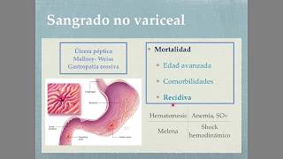 Sangrado digestivo alto y bajo [upl. by Irik]