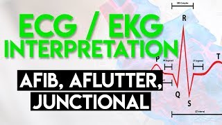 Afib Aflutter Junctional Arrhythmias  ECG EKG Interpretation Part 4 [upl. by Kcinnay]