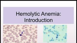 Hemolytic Anemias Introduction and Classification [upl. by Merwyn231]