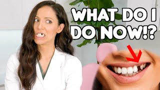 How To REPLACE A Missing Tooth Best Tooth Replacement Options [upl. by Marna]