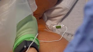 How To Ultrasound Guided Interscalene Nerve Block 3D Video [upl. by Evangelia]