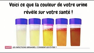 COMMENT TRAITER LES INFECTIONS URINAIRES [upl. by Shandy]