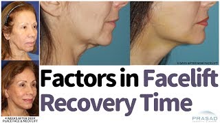 How Facelift Recovery can be Faster Without Compromising Results or Longevity [upl. by Isla]