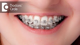 How long will it take to close the gaps with invisible braces  Dr Shobith R Shetty [upl. by Yruam800]