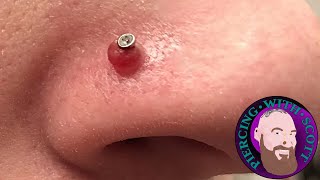 Piercing Bumps  Everything You Need To Know [upl. by Nyad]